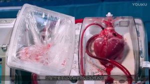 3D打印人造的心脏  像真心脏一样  能跳动3000多次  心脏病人有救了